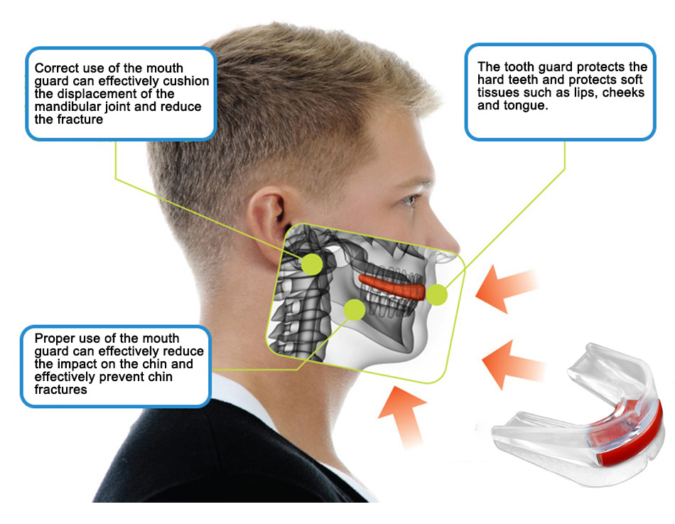 KHY06008- Anti-snore braces with eco-friendly food grade EVA2